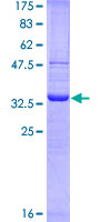 12.5% SDS-PAGE Stained with Coomassie Blue.